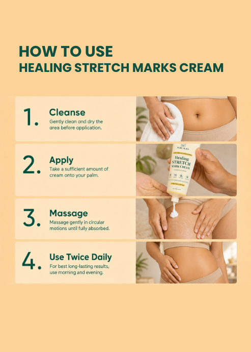 Healing Stretch Mark Cream - 75gm