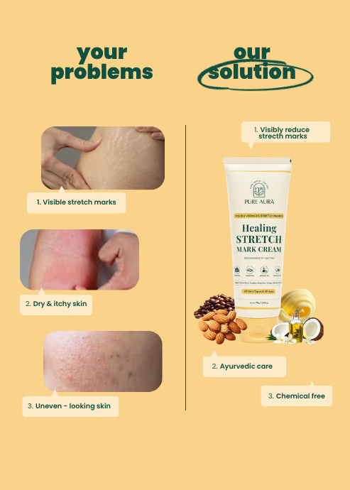 Healing Stretch Mark Cream - 75gm