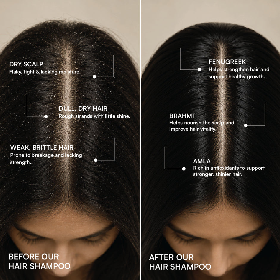 Strongroots Hair Shampoo